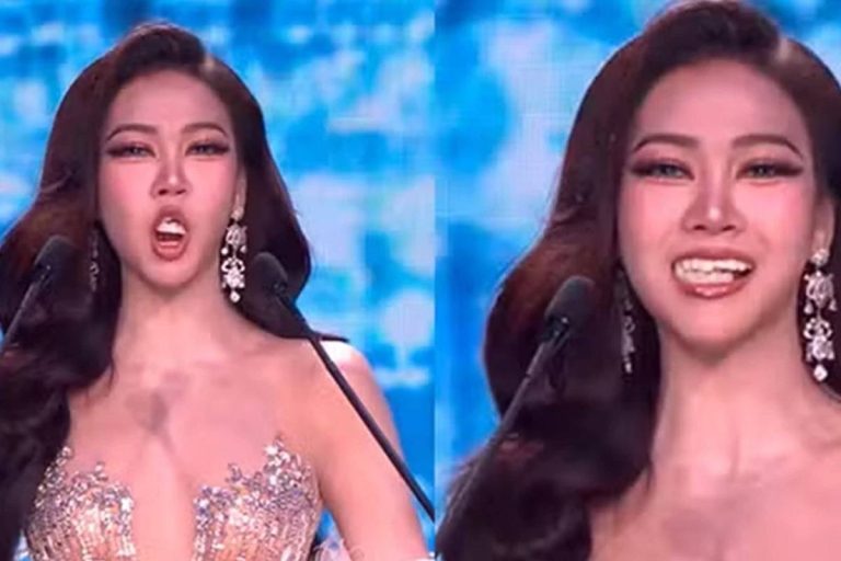 Miss viraliza ao perder dentes falsos em concurso; vídeo – 03/04/2026 – De faixa a coroa